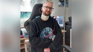 Alleingelassen mit Wunden: Michael Schoppa aus Lahr leidet unter der Schmetterlingskrankheit