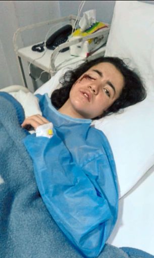 Alia liegt nach der Operation im Krankenhaus in Aleppo. Die komplizierte OP war erfolgreich. Foto: privat